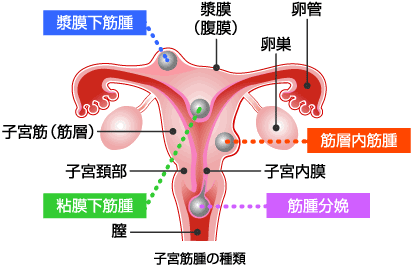 私だけ？自分の身体の謎