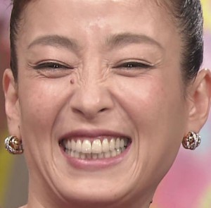 人の歯気になりますか？