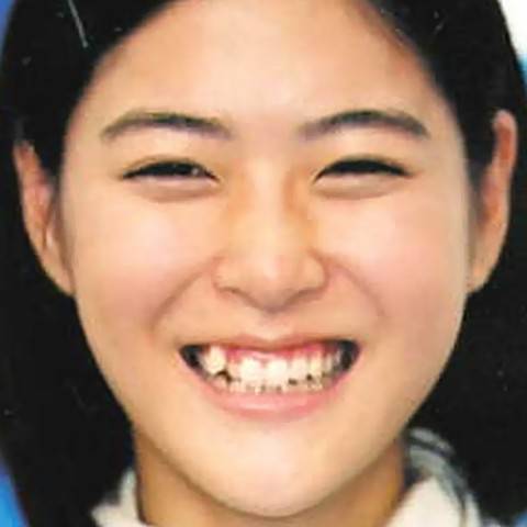 人の歯気になりますか？
