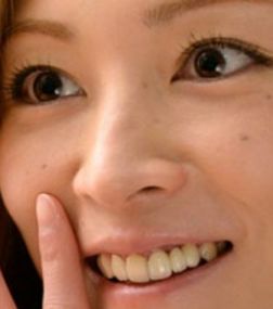 人の歯気になりますか？