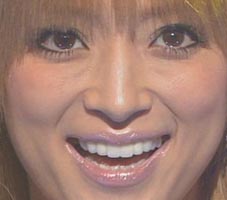 人の歯気になりますか？