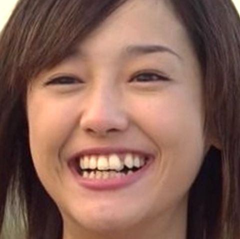 人の歯気になりますか？