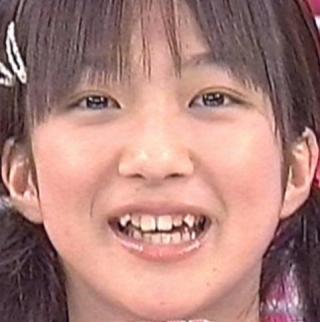 人の歯気になりますか？