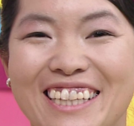 人の歯気になりますか？