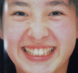 人の歯気になりますか？