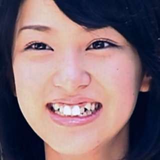 人の歯気になりますか？