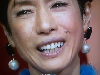 人の歯気になりますか？