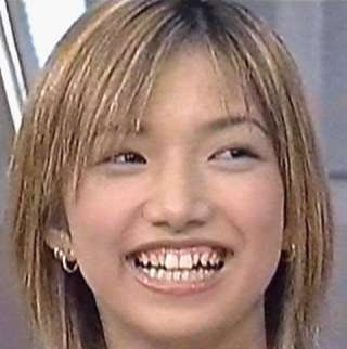 人の歯気になりますか？