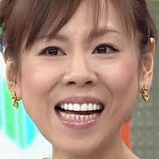 人の歯気になりますか？