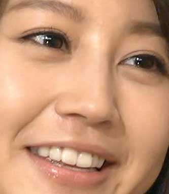 人の歯気になりますか？