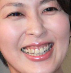 人の歯気になりますか？