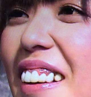 人の歯気になりますか？