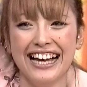 人の歯気になりますか？