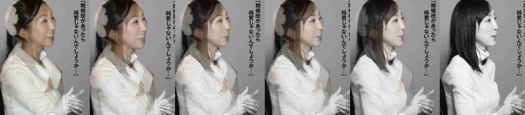 もし友達に整形し過ぎな人がいたらどうしますか?