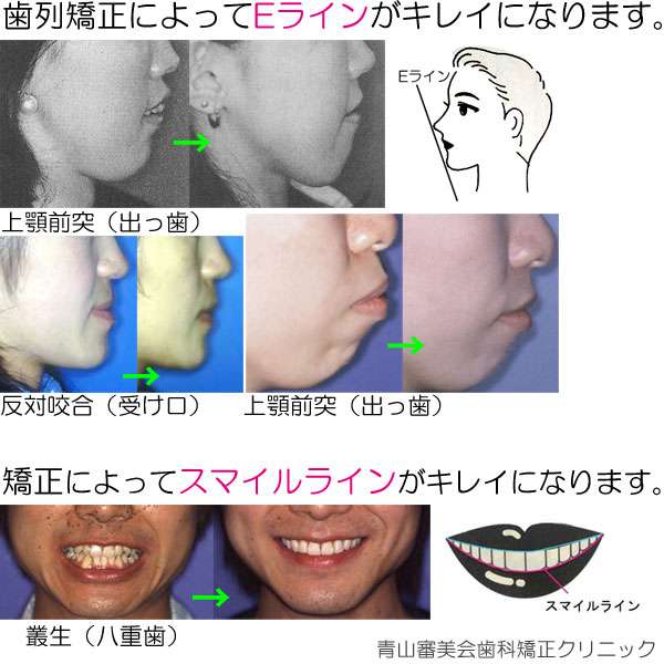 イケメンの基準