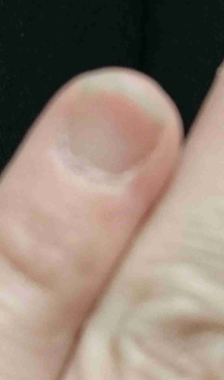 爪が汚い人、集合