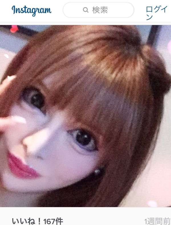 【閲覧注意】整形サイボーグ・ヴァニラがアゴ削りすぎ…？肉体の限界を心配する声