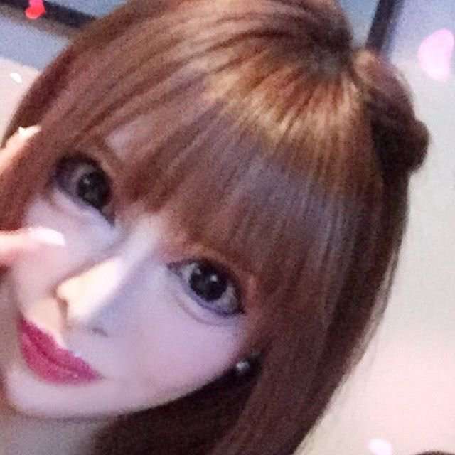 【閲覧注意】整形サイボーグ・ヴァニラがアゴ削りすぎ…？肉体の限界を心配する声