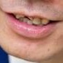 顔の一部で誰か当てるトピ
