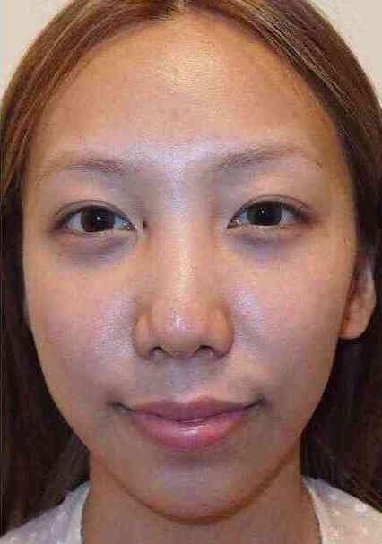 SMAP中居正広がざわちんの歌唱力に辛らつな評価「ものすごい普通」