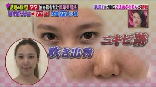 SMAP中居正広がざわちんの歌唱力に辛らつな評価「ものすごい普通」
