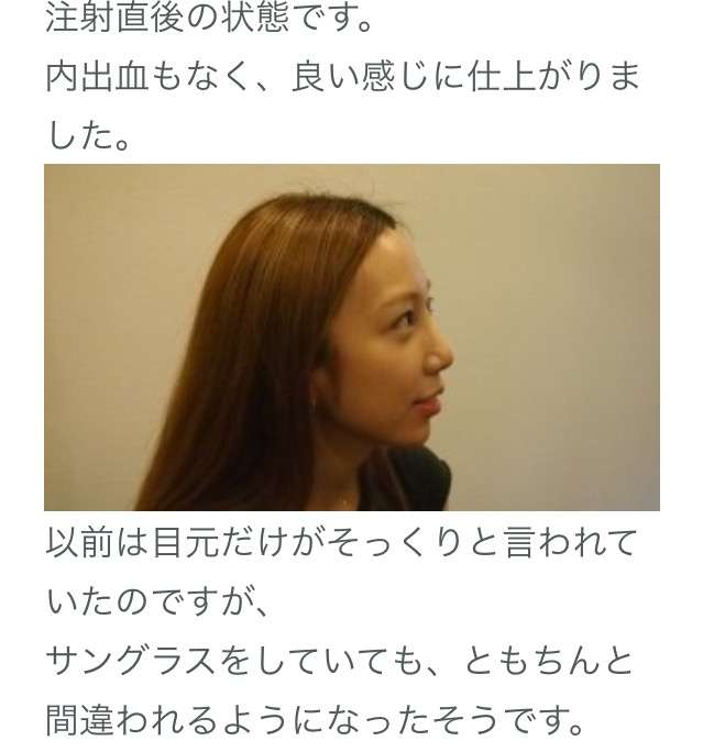 SMAP中居正広がざわちんの歌唱力に辛らつな評価「ものすごい普通」