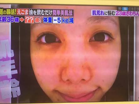 SMAP中居正広がざわちんの歌唱力に辛らつな評価「ものすごい普通」