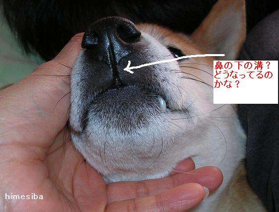 鼻と口の間にある縦筋(人中)が苦手な人!!