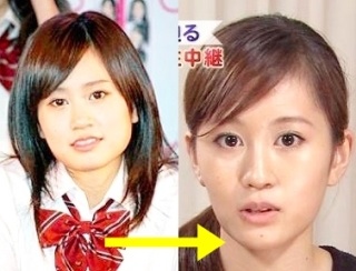 栗山千明の新CMでエラの違いが歴然に ネットでは「また顎削った？」と指摘