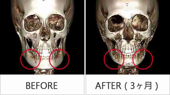 栗山千明の新CMでエラの違いが歴然に ネットでは「また顎削った？」と指摘