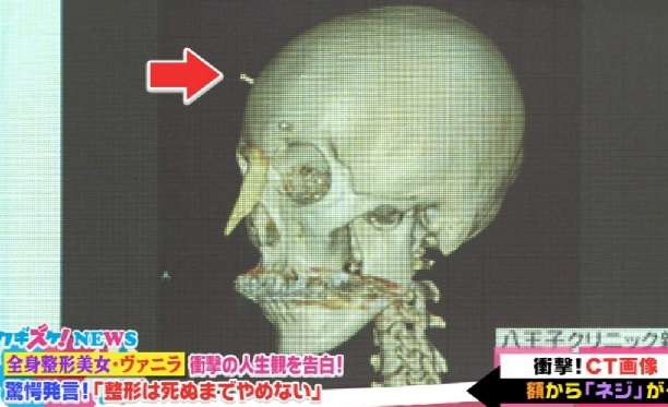 鼻にコンプレックスある人！