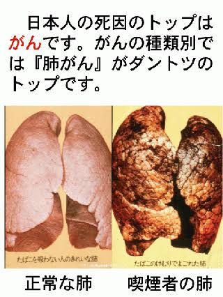 隣人のタバコの煙、どうしますか?