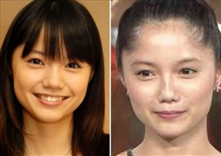 鼻の整形したことある人