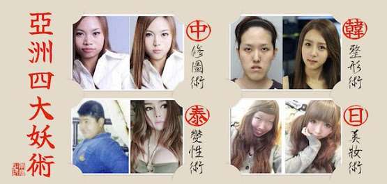 注射だけ……気軽にできる「プチ整形」でまさかの失明！