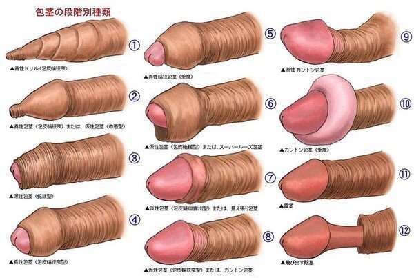 【本日の下ネタトピ】男性のアレの皮についてどう思うか