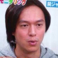 おでこの形教えてください!