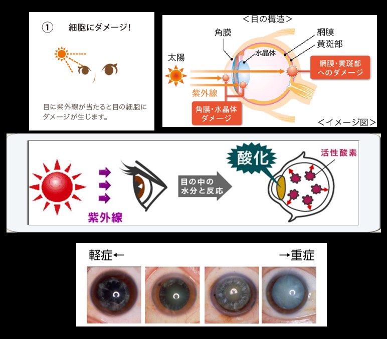 アンチエイジング何していますか?