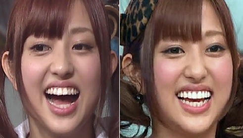 肥満が美とされる国もある! 古今東西10の女性の美しさの基準