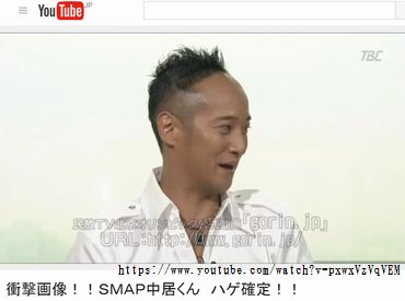 おでこを出している芸能人の画像を貼るトピ