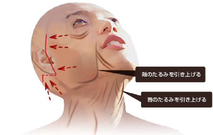 体のたるみ気になりませんか？