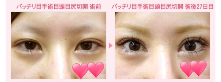整形していないと思うイケメン美人の芸能人