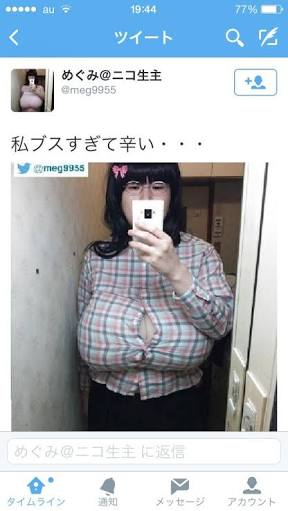 巨乳にしすぎて後悔した女性、仕事への影響恐れ減胸には踏み切れず。