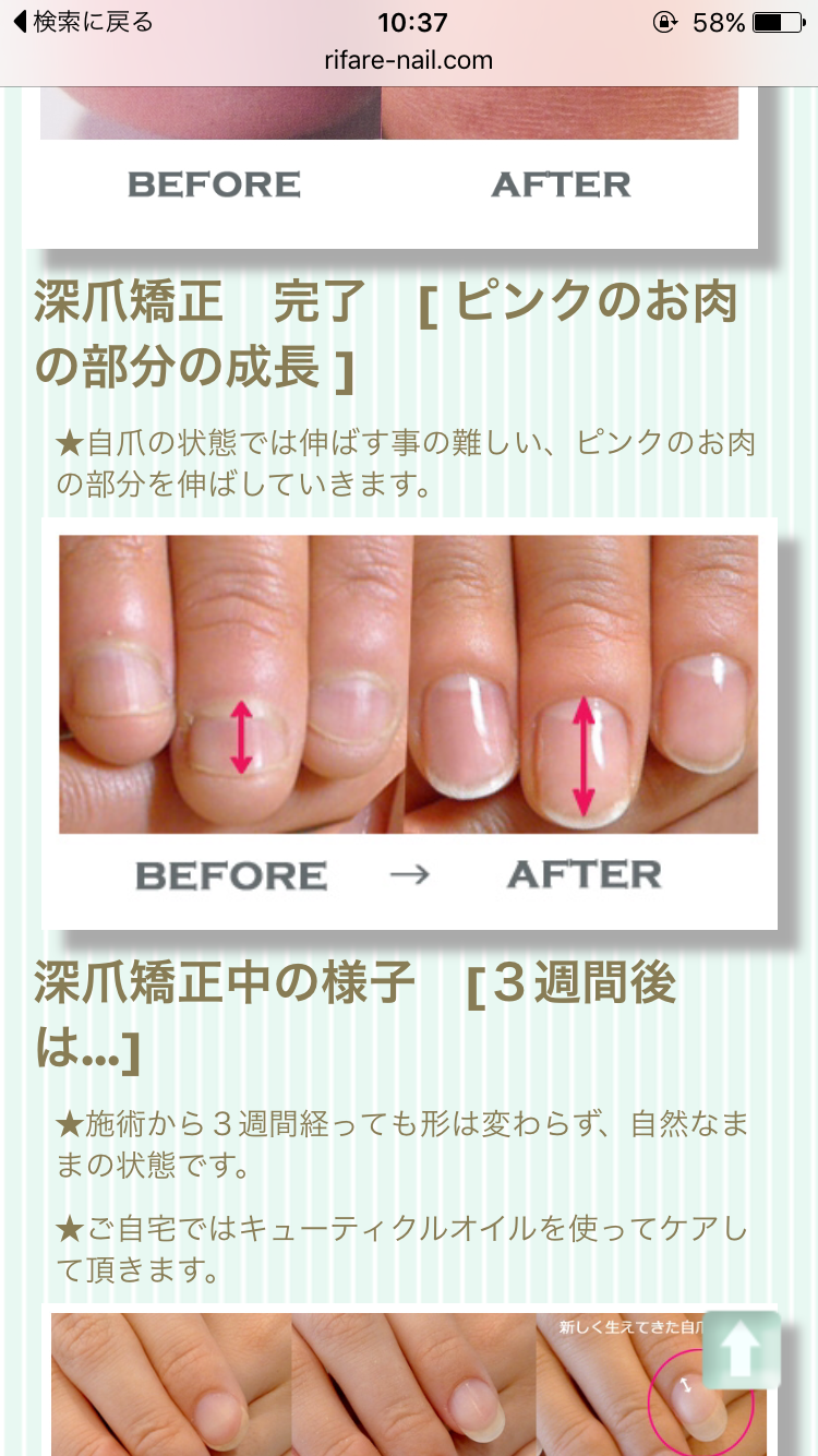 爪噛む癖があった方 ガールズちゃんねる Girls Channel