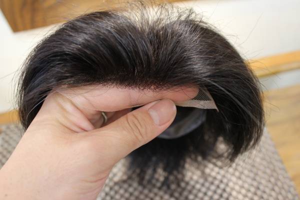 髪が薄い人！！対策何してますか？