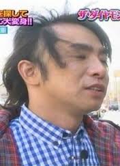 髪が薄い人！！対策何してますか？