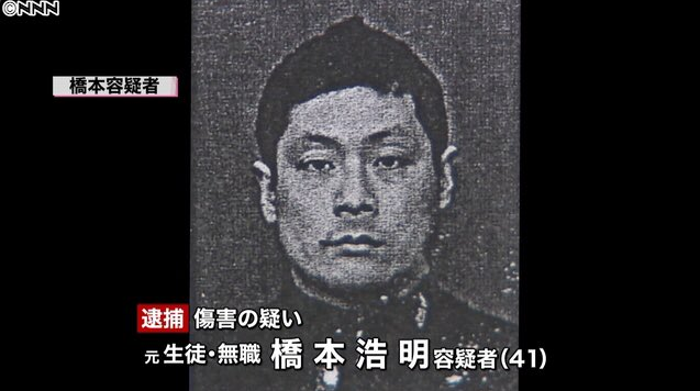 バレエ教室講師の指切断の疑い 生徒の男を逮捕