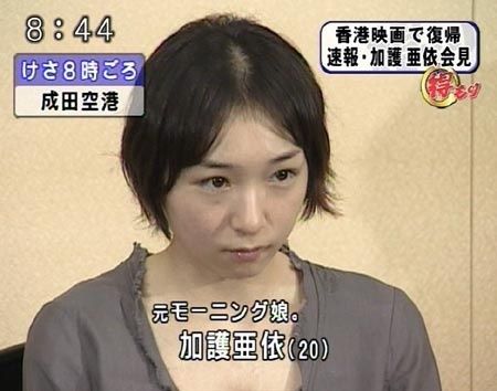 髪の悩みありますか？