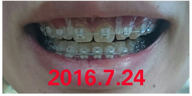 自分の身体で気になること