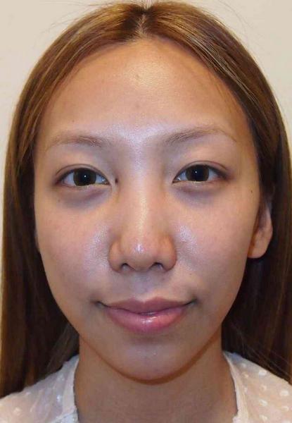 ざわちんの“きゃりー”ものまねメイク大絶賛