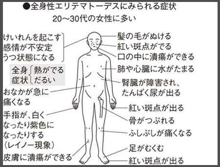 セレーナ・ゴメスが休養を発表 難病による鬱などの悪化で